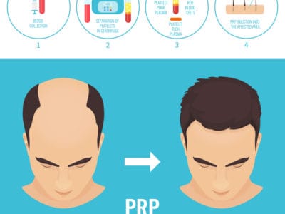Is PRP Right For You?