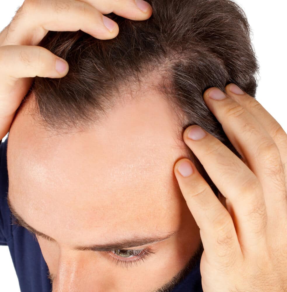 Why Does Hair Transplant Fail? - AZ Hair Restoration