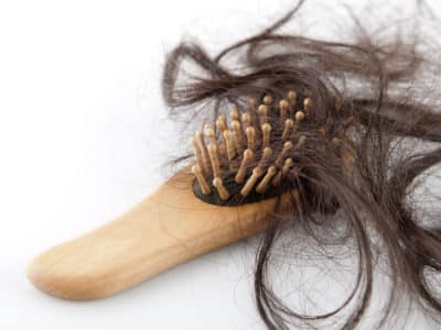 Cancer and Hair Loss