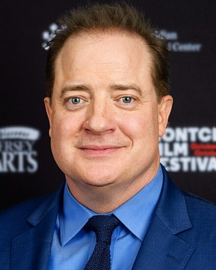 Can You Benefit From Hair Transplant Like Brendan Fraser’s Hair Transplant